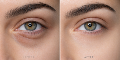 Light Aura Crème Yeux C + Peptides
